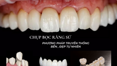 Photo of Bọc răng sứ thẩm mỹ  tại Lạng Sơn