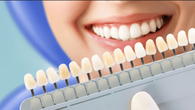 Photo of Tẩy trắng răng ở Lạng Sơn – Tuốt lại sự trắng sáng của hàm răng